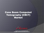 Cone Beam Computed Tomography (CBCT) Market