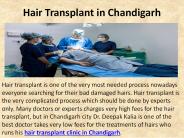 Hair Transplant Clinic in Chandigarh