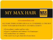 Best Hair Replacement Company in India