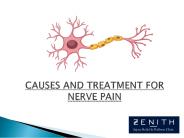 Causes and Treatment for Nerve Pain