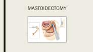 Mastoidectomy - Meddco