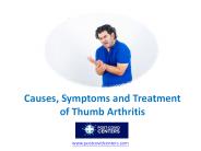 Causes, Symptoms and Treatment of Thumb Arthritis