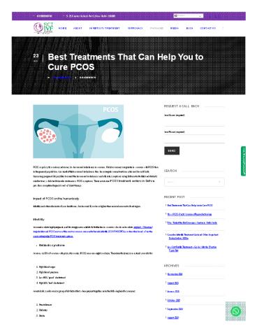 Best Treatments That Can Help You to Cure PCOS