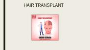 Hair Transplant - Meddco