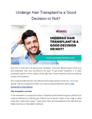 Undergo Hair Transplant is a Good Decision or Not?