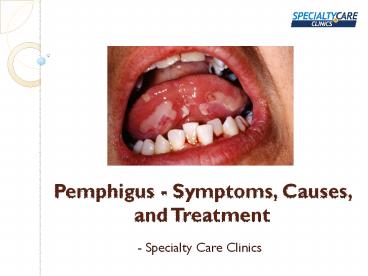 Pemphigus: Causes, Symptoms, Risk Factors & Treatment