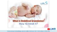What Is Umbilical Granuloma? How To Treat It? (1)
