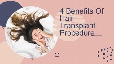 4 Benefits of Hair Transplant Procedure