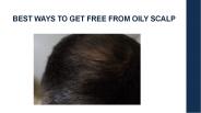 BEST WAYS TO GET FREE FROM OILY SCALP