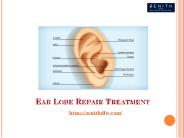 Ear Lobe Repair Treatment