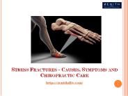 Stress Fractures - Causes, Symptoms and Chiropractic Care