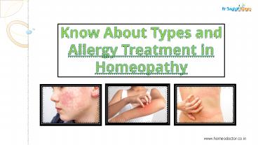 Know About Types and Allergy Treatment in Homeopathy