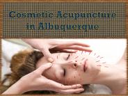 Cosmetic Acupuncture In Albuquerque