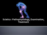 Sciatica : Pathophysiology, Examination, Treatment