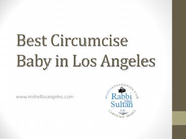 Best Circumcise Baby in Los Angeles - Mohellosangeles.com
