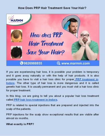​How Does PRP Hair Treatment Save Your Hair?