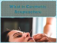 What is Cosmetic Acupuncture?