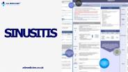 Sinusitis Nice CKS | A4 Medicine
