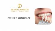 All About Veneers - Dentist In Scottsdale