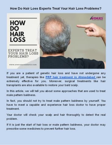 How Do Hair Loss Experts Treat Your Hair Loss Problems?