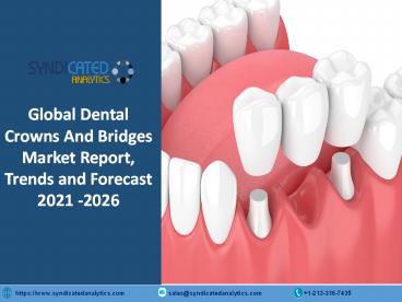 Dental Crowns and Bridges Market Research Report 2021-2026 | Syndicated Analytics