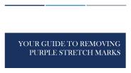 Your Guide To Removing Purple Stretch Marks