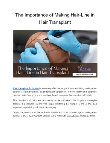 The Importance of Making Hair-Line in Hair Transplant