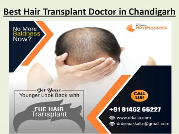 Best Hair Transplant Doctor in Chandigarh