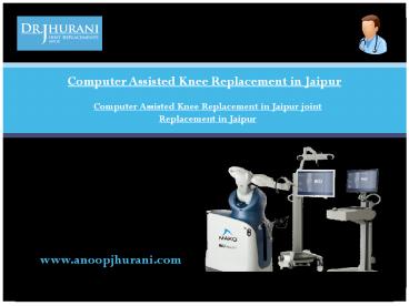 Computer Assisted Knee Replacement in Jaipur joint Replacement in Jaipur