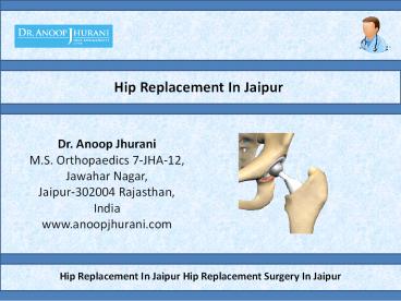 Hip Replacement In Jaipur Hip Replacement Surgery In Jaipur