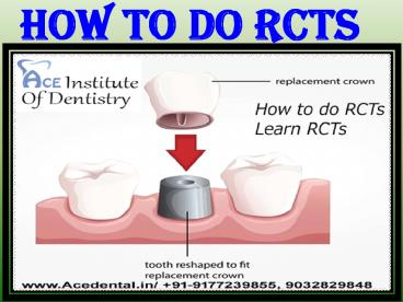 How To Do RCTs And Fees To Learn