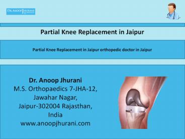 Partial Knee Replacement in Jaipur orthopedic doctor in Jaipur