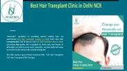 Best hair transplant treatment in delhi (1)