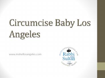 Circumcise Baby Los Angeles - Mohellosangeles.com