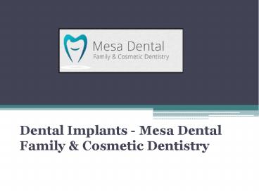 Dental Implants - Mesa Dental Family & Cosmetic Dentistry (1)