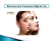 Acne Scars Treatments in Singapore