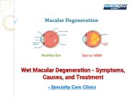 Macular Degeneration - Symptoms, Causes, and Treatment