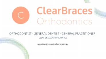 Clear Ceramic Braces, Orthodontics Braces, Sydney Orthodontics