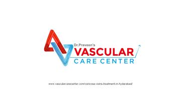 varicose veins treatment in Hyderabad - Vascularcarecenter (1)