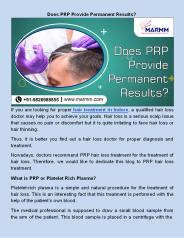 ​Does PRP Provide Permanent Results?