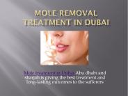 Mole Removal Treatment
