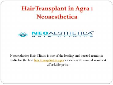 hair transplant in agra