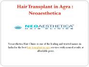 hair transplant in agra