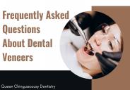 Frequently Asked Questions About Dental Veneers