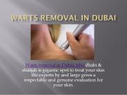 Warts Removal Surgery in Dubai