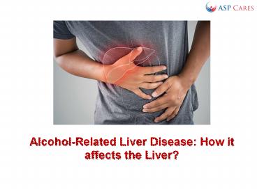 Alcohol-Related Liver Disease: How it affects the Liver?