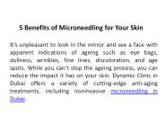 5 Benefits of Microneedling for Your Skin