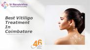 Treatment of Leucoderma in Coimbatore