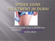 spider veins treatment in dubai