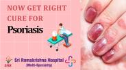 Psoriasis treatment in Coimbatore
